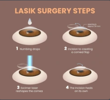 Choose Easy Blink Optometry for Laser Vision Consultations